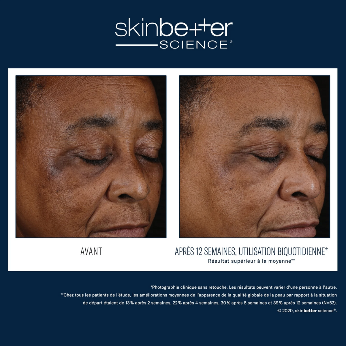 Better Balance Duo by skinbetter science, before and after | SkinCrew, Preferred Authorized skinbetter science US Retailer