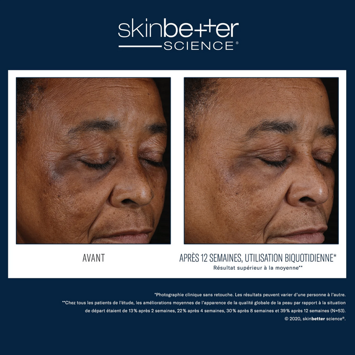 Better Balance Duo by skinbetter science, before and after | SkinCrew, Preferred Authorized skinbetter science US Retailer