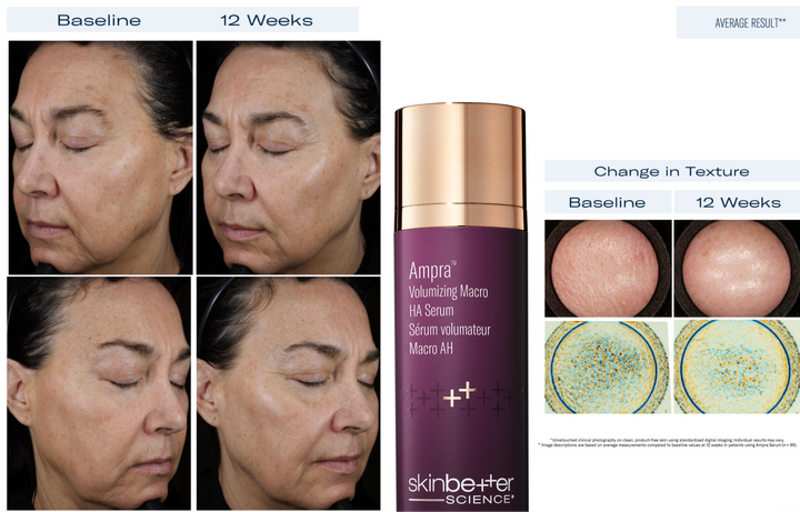 Ampra Volumizing Macro HA Serum by skinbetter science, texture | SkinCrew, Preferred Authorized skinbetter science US Retailer