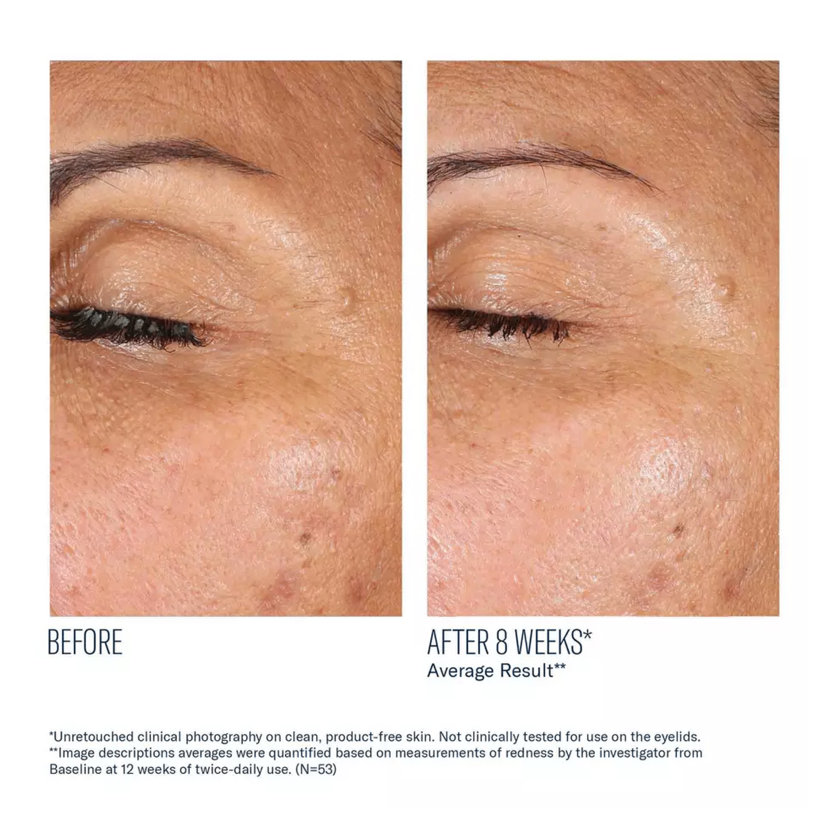 InterFuse® Treatment Cream EYE by skinbetter science, formulation | SkinCrew, Preferred Authorized skinbetter science US Retailer