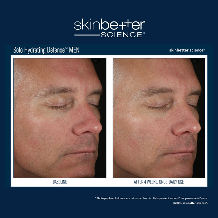 Solo Hydrating Defense MEN by skinbetter science, before and after | SkinCrew, Preferred Authorized skinbetter science US Retailer