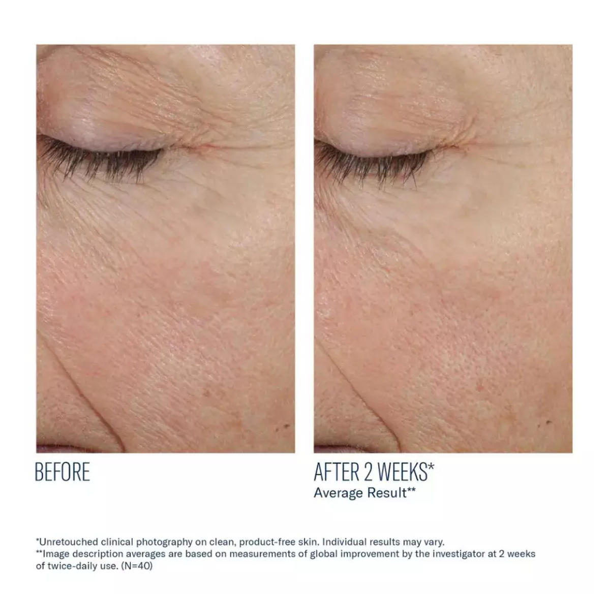 Trio Rebalancing Moisture Treatment by skinbetter science, before and after | SkinCrew, Preferred Authorized skinbetter science US Retailer