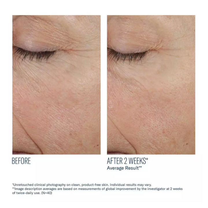 Trio Rebalancing Moisture Treatment by skinbetter science, before and after | SkinCrew, Preferred Authorized skinbetter science US Retailer